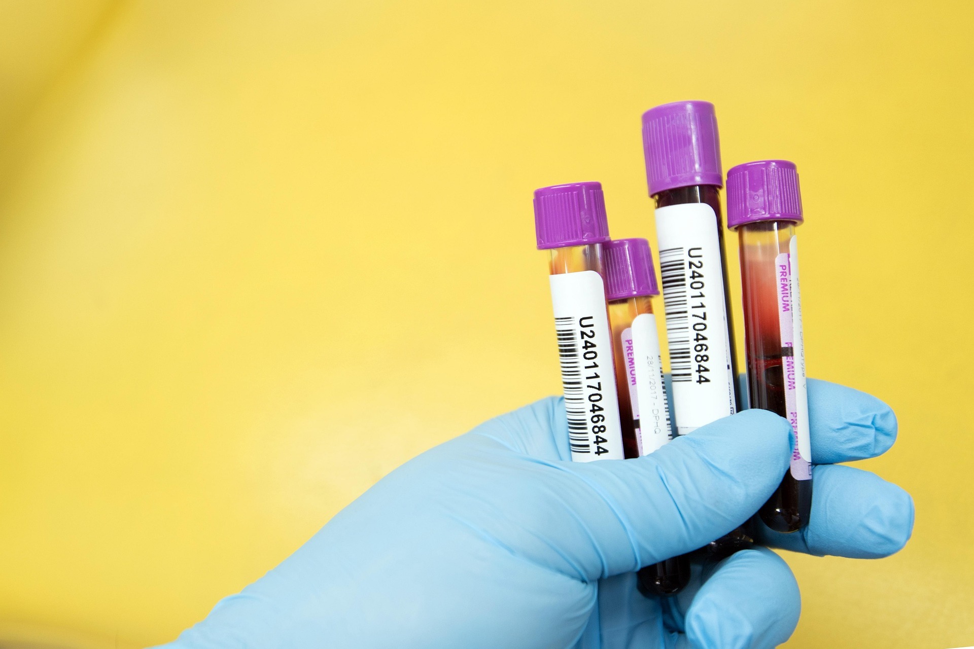 Traversing the Path from Bench to Cancer Biomarker Validation